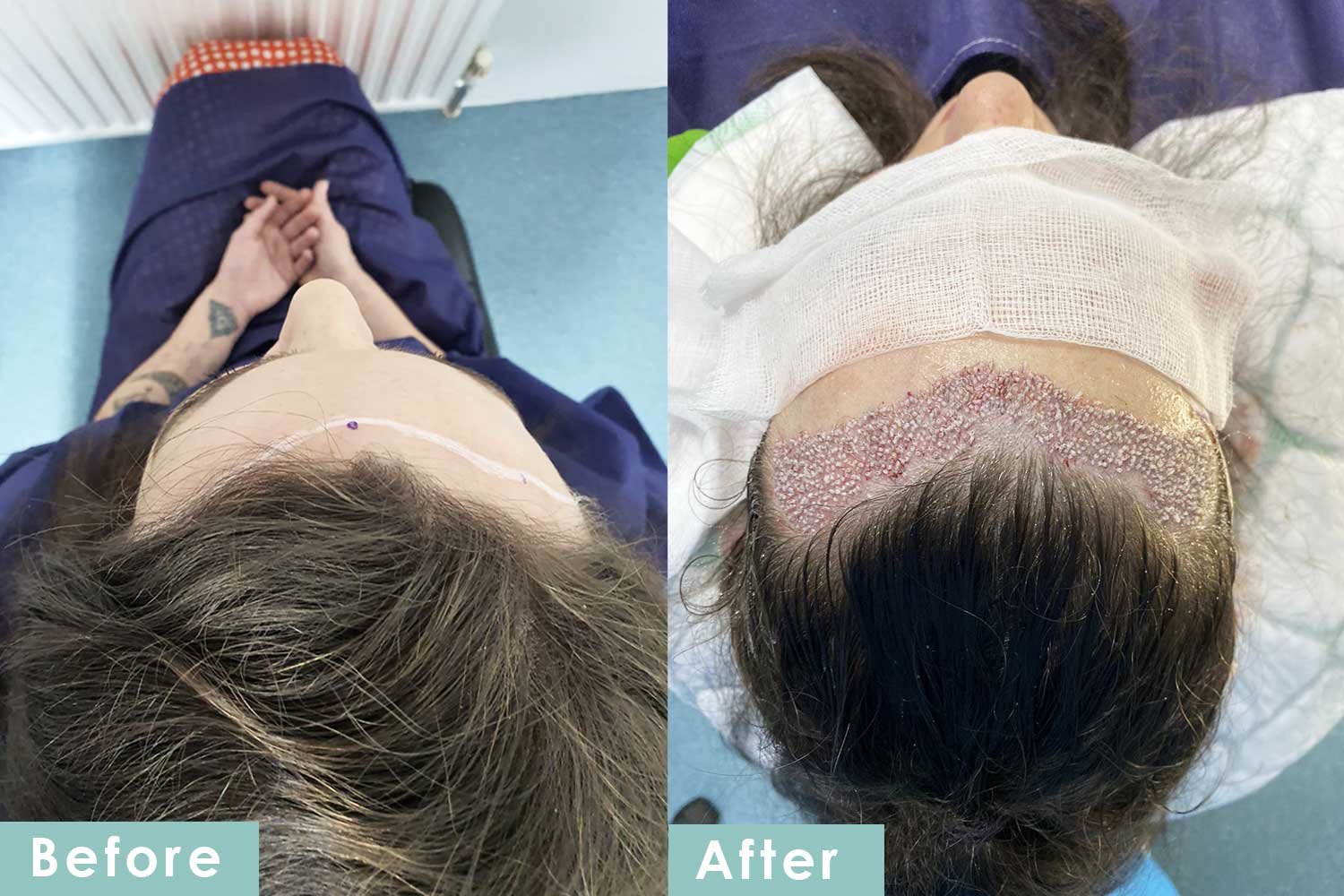 Before and After