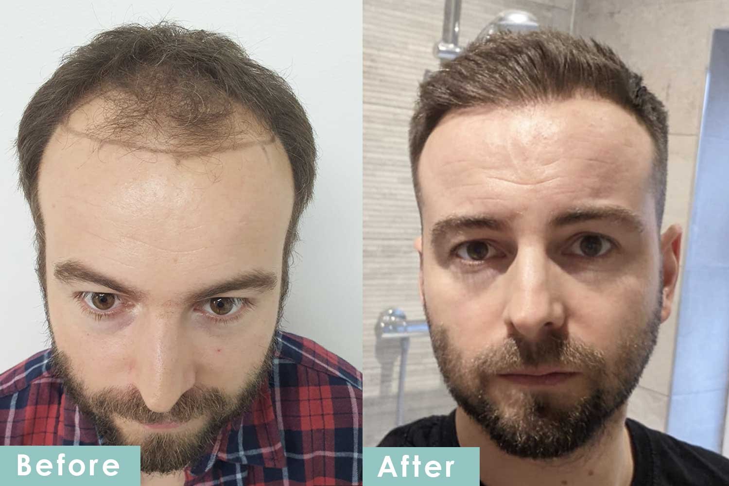 Before and After
