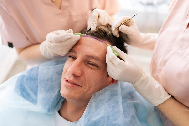 Hairline Restoration